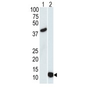 abx025175