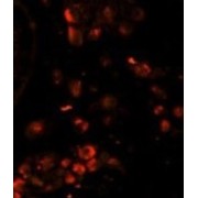 abx025177