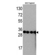 abx025179
