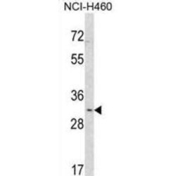 Snail Family Transcriptional Repressor 1 / SNAIL (SNAI1) Antibody