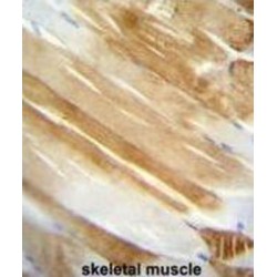 Nucleolin (NCL) Antibody