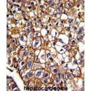 Hematopoietic Progenitor Cell Antigen CD34 (CD34) Antibody