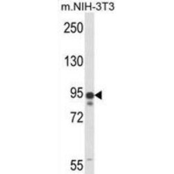 Hematopoietic Progenitor Cell Antigen CD34 (CD34) Antibody