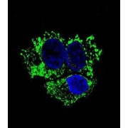Aldehyde Dehydrogenase, Mitochondrial (ALDH2) Antibody