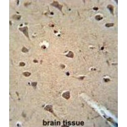 Aldehyde Dehydrogenase, Mitochondrial (ALDH2) Antibody