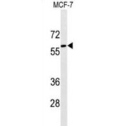 Alpha-Fetoprotein (AFP) Antibody