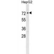 Alpha-Fetoprotein (AFP) Antibody