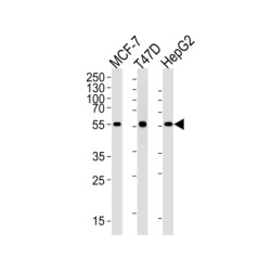 Methylmalonate-Semialdehyde Dehydrogenase [acylating], Mitochondrial (ALDH6A1) Antibody