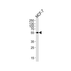 Methylmalonate-Semialdehyde Dehydrogenase [acylating], Mitochondrial (ALDH6A1) Antibody