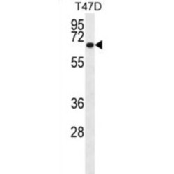 Matrix Metalloproteinase 2 (MMP2) Antibody