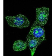 Acyl Coenzyme A Oxidase 1, Palmitoyl (ACOX1) Antibody