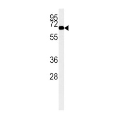 Acyl Coenzyme A Oxidase 1, Palmitoyl (ACOX1) Antibody