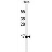 Thioesterase Superfamily Member 2 (THEM2) Antibody