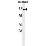 Tyrosine Kinase Non Receptor 1 (TNK1) Antibody