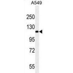 Retinol (RET) Antibody