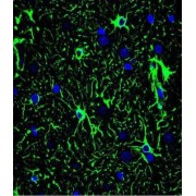 Glial Fibrillary Acidic Protein (GFAP) Antibody