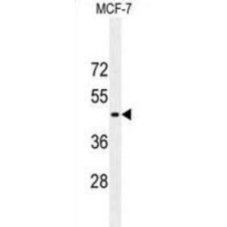 Glial Fibrillary Acidic Protein (GFAP) Antibody