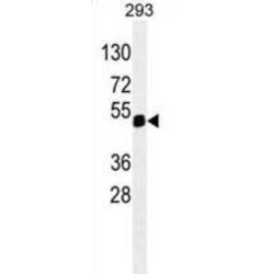 Paired Box Protein Pax-6 (PAX6) Antibody