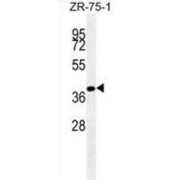 abx025235