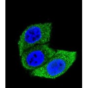 abx025238