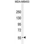 Estrogen Receptor (ESR1) Antibody