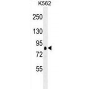 Ribosomal Protein S6 Kinase Alpha 1 (RPS6KA1) Antibody