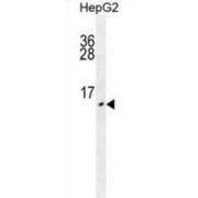 Ubiquitin-Related Modifier 1 (URM1) Antibody
