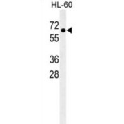 5'-AMP-Activated Protein Kinase Catalytic Subunit Alpha-2 (PRKAA2) Antibody