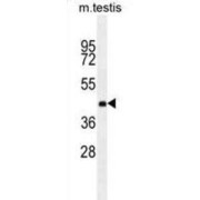Zinc Finger Protein 622 (ZNF622) Antibody