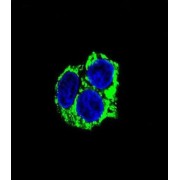 abx025256
