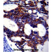 abx025259