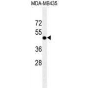 abx025264