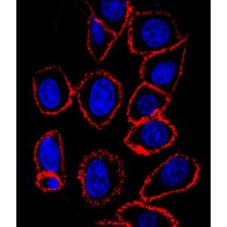 CD44 Antigen (CD44) Antibody