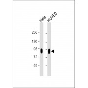 Western blot analysis of extracts of HeLa and HUVEC whole cell lysates using anti-CD44 antibody (1/2000 dilution).