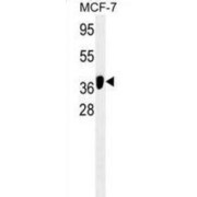 abx025271