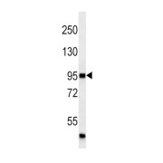 abx025273