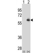 abx025277