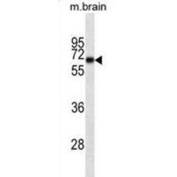 Internexin Neuronal Intermediate Filament Protein Alpha (INA) Antibody