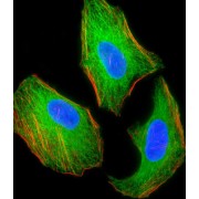 Tuberous Sclerosis Protein 2 (TSC2) Antibody