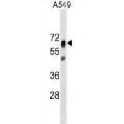 Protein Tyrosine Phosphatase, Non Receptor Type 11 (PTPN11) Antibody