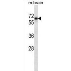 Protein Tyrosine Phosphatase, Non Receptor Type 11 (PTPN11) Antibody