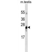 Glutathione S Transferase Alpha 1 (GSTA1) Antibody