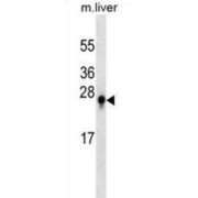 abx025310