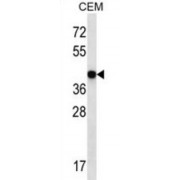 Mitogen-Activated Protein Kinase 3 / ERK1 (MAPK3) Antibody