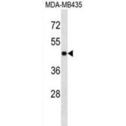 Mitogen-Activated Protein Kinase 3 / ERK1 (MAPK3) Antibody