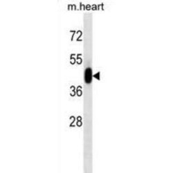 Mitogen-Activated Protein Kinase 3 / ERK1 (MAPK3) Antibody