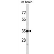 abx025314