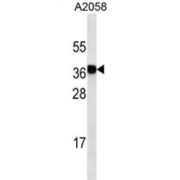 Lectin-Galactoside Binding Soluble 3 (LGALS3) Antibody