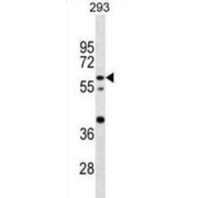 CCR4-NOT Transcription Complex Subunit 4 (CNOT4) Antibody