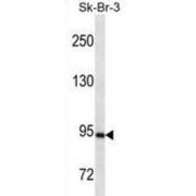 abx025331